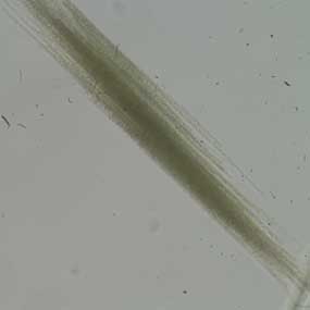 Aphanizomenon Cyanobacteria